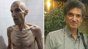  کنشگری با استخوان‌های بیرون‌زده